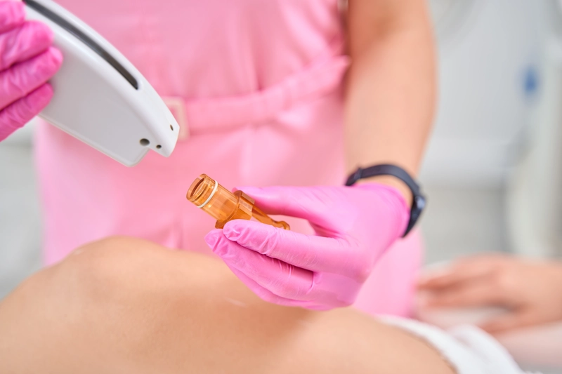 laser hair removal process