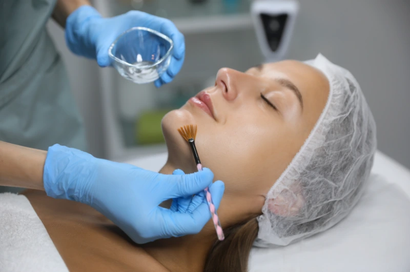 benefits of medical grade chemical peels