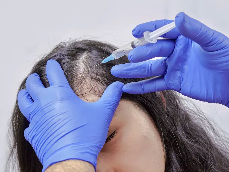 benefits of stem cell hair treatment