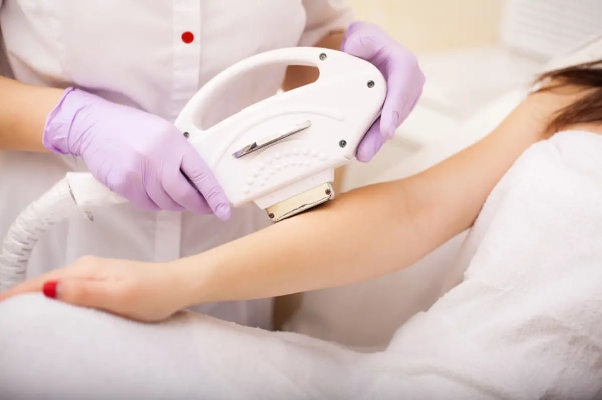 photorejuvenation treatment in fountain valley ca