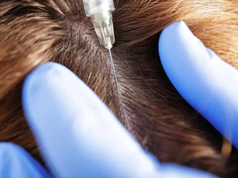 what is stem cell hair regrowth