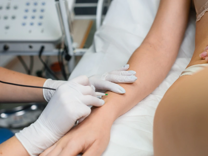 electrolysis vs laser hair removal result