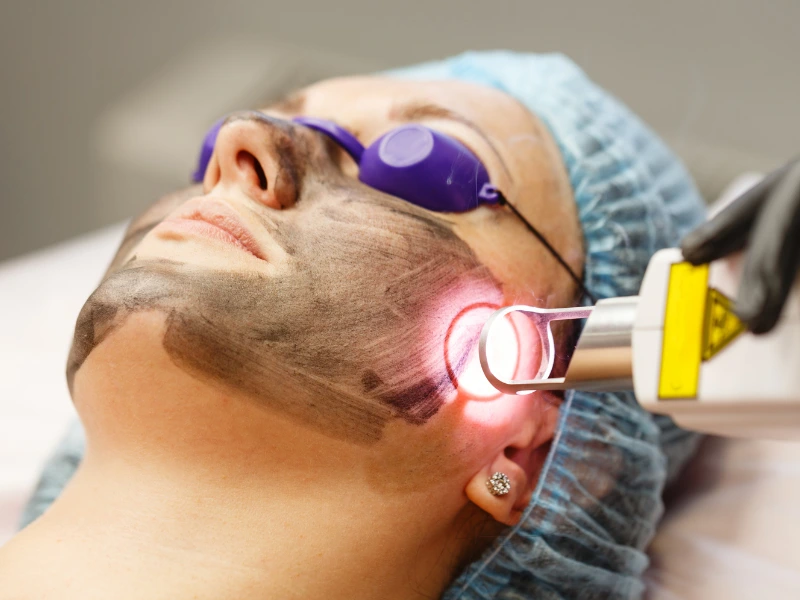 electrolysis vs laser hair removal