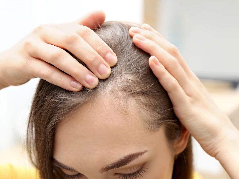 semaglutide and hair growth
