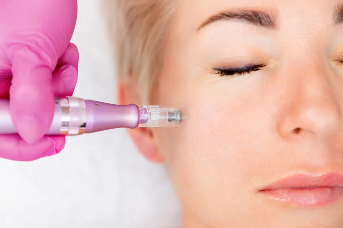 Does Microneedling Tighten Skin