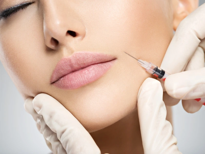 botox timeline