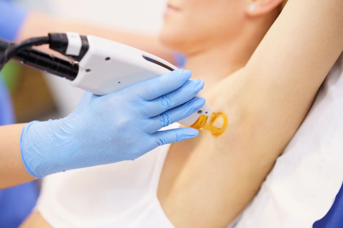 does laser hair removal cause cancer