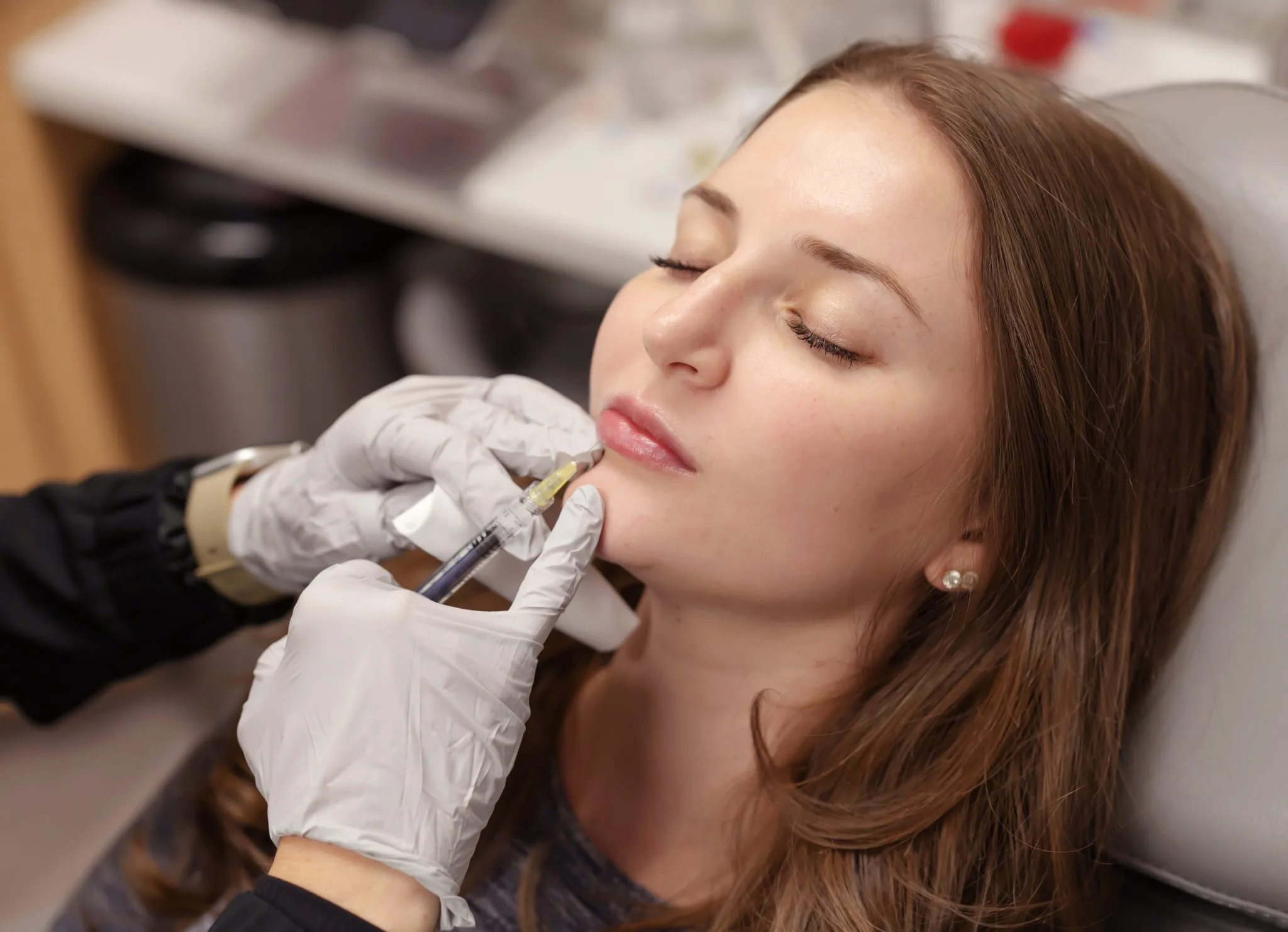 Juvéderm Treatment